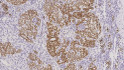Anti-Wilms NA Tumor antibody [WT49] (STJ16101804)