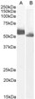 STJ73743 (0. 3µg/ml) staining of Human (A) and (0. 1ug/ml) Rat (B) Spleen lysate (35µg protein in RIPA buffer).