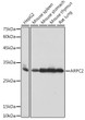 Western blot analysis of various lysates using ARPC2 Rabbit monoclonal antibody (STJ11102755) at 1:1000 dilution. Secondary antibody: HRP Goat Anti-Rabbit IgG (H+L) (STJS000856) at 1:10000 dilution. Lysates/proteins: 25 Mu g per lane. Blocking buffer: 3% nonfat dry milk in TBST. Detection: ECL Basic Kit. Exposure time: 1s.