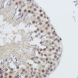 Immunohistochemistry analysis of paraffin-embedded rat testis using USP39 Rabbit monoclonal antibody (STJ11102757) at dilution of 1:100 (40x lens). Perform high pressure antigen retrieval with 10 mM citrate buffer pH 6. 0 before commencing with immunohistochemistry staining protocol.