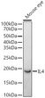 Western blot analysis of lysates from Mouse eye, using IL4 Rabbit polyclonal antibody (STJ11102765) at 1:700 dilution. Secondary antibody: HRP Goat Anti-Rabbit IgG (H+L) (STJS000856) at 1:10000 dilution. Lysates/proteins: 25 Mu g per lane. Blocking buffer: 3% nonfat dry milk in TBST. Detection: ECL Basic Kit. Exposure time: 30s.