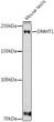 Western blot analysis of extracts of various cell lines, using DNMT1 antibody (STJ11102767) at 1:1000 dilution. Secondary antibody: HRP Goat Anti-rabbit IgG (H+L) (STJS000856) at 1:10000 dilution. Lysates/proteins: 25 Mu g per lane. Blocking buffer: 3% non-fat dry milk in TBST. Detection: ECL Basic Kit. Exposure time: 180s.