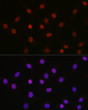 Immunofluorescence analysis of NIH-3T3 cells using Acetyl-HMGB1-K29 Rabbit polyclonal antibody (STJ11102770) at dilution of 1:100 (40x lens). Secondary antibody: Cy3 Goat Anti-Rabbit IgG (H+L) at 1:500 dilution. Blue: DAPI for nuclear staining.