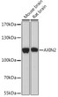 Western blot analysis of extracts of various cell lines, using AXIN2 Rabbit polyclonal antibody (STJ11102832) at 1:1000 dilution. Secondary antibody: HRP Goat Anti-Rabbit IgG (H+L) (STJS000856) at 1:10000 dilution. Lysates/proteins: 25 Mu g per lane. Blocking buffer: 3% nonfat dry milk in TBST. Detection: ECL Basic Kit. Exposure time: 180s.