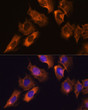 Immunofluorescence analysis of C6 cells using CAMKV Rabbit polyclonal antibody (STJ11102881) at dilution of 1:100. Secondary antibody: Cy3 Goat Anti-Rabbit IgG (H+L) at 1:500 dilution. Blue: DAPI for nuclear staining.