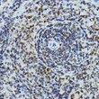 Immunohistochemistry analysis of PAXIP1 in paraffin-embedded rat spleen using PAXIP1 Rabbit polyclonal antibody (STJ11102906) at dilution of 1:100 (40x lens). Perform high pressure antigen retrieval with 10 mM citrate buffer pH 6. 0 before commencing with immunohistochemistry staining protocol.