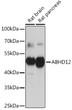 Western blot analysis of various lysates using ABHD12 Rabbit polyclonal antibody (STJ11102925) at 1:1000 dilution. Secondary antibody: HRP Goat Anti-Rabbit IgG (H+L) (STJS000856) at 1:10000 dilution. Lysates/proteins: 25 Mu g per lane. Blocking buffer: 3% nonfat dry milk in TBST. Detection: ECL Basic Kit. Exposure time: 10s.