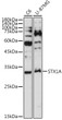 Western blot analysis of extracts of various cell lines, using STX1A antibody (STJ11102975) at 1:1000 dilution. Secondary antibody: HRP Goat Anti-Rabbit IgG (H+L) (STJS000856) at 1:10000 dilution. Lysates/proteins: 25 Mu g per lane. Blocking buffer: 3% nonfat dry milk in TBST. Detection: ECL Basic Kit. Exposure time: 180s.