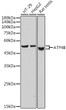Western blot analysis of extracts of various cell lines, using ATP4B antibody (STJ11103011) at 1:1000 dilution. Secondary antibody: HRP Goat Anti-Rabbit IgG (H+L) (STJS000856) at 1:10000 dilution. Lysates/proteins: 25 Mu g per lane. Blocking buffer: 3% nonfat dry milk in TBST. Detection: ECL Basic Kit. Exposure time: 1s.