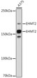 Western blot analysis of extracts of A375 cells, using EHMT2 antibody (STJ11103018) at 1:1000 dilution. Secondary antibody: HRP Goat Anti-rabbit IgG (H+L) (STJS000856) at 1:10000 dilution. Lysates/proteins: 25 Mu g per lane. Blocking buffer: 3% non-fat dry milk in TBST. Detection: ECL Basic Kit. Exposure time: 30s.
