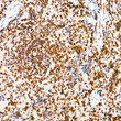 Immunohistochemistry analysis of EHMT2 in paraffin-embedded rat spleen tissue using EHMT2 rabbit monoclonal antibody (STJ11103018) at a dilution of 1:200 (40x lens). High pressure antigen retrieval was performed with 0. 01 M citrate buffer (pH 6. 0) prior to immunohistochemistry staining.