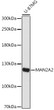 Western blot analysis of lysates from U-87MG cells, using MAN2A2 Rabbit polyclonal antibody (STJ11103025) at 1:1000 dilution. Secondary antibody: HRP Goat Anti-Rabbit IgG (H+L) (STJS000856) at 1:10000 dilution. Lysates/proteins: 25 Mu g per lane. Blocking buffer: 3% nonfat dry milk in TBST. Detection: ECL Basic Kit. Exposure time: 180s.