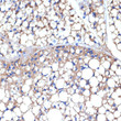 Immunohistochemistry analysis of paraffin-embedded mouse brown adipose using UCP1+UCP3 Rabbit monoclonal antibody (STJ11103032) at dilution of 1:100 (40x lens). Perform microwave antigen retrieval with 10 mM Tris/EDTA buffer pH 9. 0 before commencing with immunohistochemistry staining protocol.