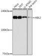 Western blot analysis of extracts of various cell lines, using ABL2 Rabbit monoclonal antibody (STJ11103060) at 1:1000 dilution. Secondary antibody: HRP Goat Anti-Rabbit IgG (H+L) (STJS000856) at 1:10000 dilution. Lysates/proteins: 25 Mu g per lane. Blocking buffer: 3% nonfat dry milk in TBST. Detection: ECL Basic Kit. Exposure time: 90s.