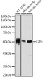 Western blot analysis of extracts of various cell lines, using E2F4 antibody (STJ11103078) at 1:1000 dilution. Secondary antibody: HRP Goat Anti-Rabbit IgG (H+L) (STJS000856) at 1:10000 dilution. Lysates/proteins: 25 Mu g per lane. Blocking buffer: 3% nonfat dry milk in TBST. Detection: ECL Enhanced Kit. Exposure time: 180s.