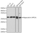 Western blot analysis of extracts of various cell lines, using Hippocalcin (HPCA) (HPCA) Rabbit monoclonal antibody (STJ11103084) at 1:1000 dilution. Secondary antibody: HRP Goat Anti-Rabbit IgG (H+L) (STJS000856) at 1:10000 dilution. Lysates/proteins: 25 Mu g per lane. Blocking buffer: 3% nonfat dry milk in TBST. Detection: ECL Basic Kit. Exposure time: 180s. Western blot analysis of extracts of various cell lines, using Hippocalcin (HPCA) (HPCA) Rabbit monoclonal antibody (STJ11103084) at 1:1000 dilution. Secondary antibody: HRP Goat Anti-Rabbit IgG (H+L) (STJS000856) at 1:10000 dilution. Lysates/proteins: 25 Mu g per lane. Blocking buffer: 3% nonfat dry milk in TBST. Detection: ECL Basic Kit. Exposure time: 180s.