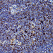 Immunohistochemistry analysis of paraffin-embedded human tonsil using Human IgM Rabbit monoclonal antibody (STJ11103092) at dilution of 1:100 (40x lens). Perform high pressure antigen retrieval with 10 mM citrate buffer pH 6. 0 before commencing with immunohistochemistry staining protocol.