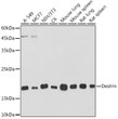 Western blot analysis of extracts of various cell lines, using Destrin Rabbit monoclonal antibody (STJ11103125) at 1:1000 dilution. Secondary antibody: HRP Goat Anti-Rabbit IgG (H+L) (STJS000856) at 1:10000 dilution. Lysates/proteins: 25 Mu g per lane. Blocking buffer: 3% nonfat dry milk in TBST. Detection: ECL Basic Kit. Exposure time: 30s. Western blot analysis of extracts of various cell lines, using Destrin Rabbit monoclonal antibody (STJ11103125) at 1:1000 dilution. Secondary antibody: HRP Goat Anti-Rabbit IgG (H+L) (STJS000856) at 1:10000 dilution. Lysates/proteins: 25 Mu g per lane. Blocking buffer: 3% nonfat dry milk in TBST. Detection: ECL Basic Kit. Exposure time: 30s.
