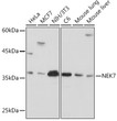 Western blot analysis of extracts of various cell lines, using NEK7 Rabbit monoclonal antibody (STJ11103156) at 1:1000 dilution. Secondary antibody: HRP Goat Anti-Rabbit IgG (H+L) (STJS000856) at 1:10000 dilution. Lysates/proteins: 25 Mu g per lane. Blocking buffer: 3% nonfat dry milk in TBST. Detection: ECL Basic Kit. Exposure time: 30s.