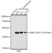 Western blot analysis of extracts of normal 293T cells 293T transfected with N Protein, using SARS-CoV-2 N Protein Mouse monoclonal antibody (STJ11103176) at 1:1000 dilution. Secondary antibody: HRP Goat Anti-Mouse IgG (H+L) at 1:10000 dilution. Lysates/proteins: 25 Mu g per lane. Blocking buffer: 3% nonfat dry milk in TBST. Detection: ECL Basic Kit. Exposure time: 5s.