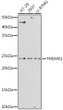 Western blot analysis of various lysates using TMEM61 Rabbit polyclonal antibody (STJ11103183) at 1:1000 dilution. Secondary antibody: HRP Goat Anti-Rabbit IgG (H+L) (STJS000856) at 1:10000 dilution. Lysates/proteins: 25 Mu g per lane. Blocking buffer: 3% nonfat dry milk in TBST. Detection: ECL Basic Kit. Exposure time: 180s.