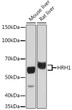 Western blot analysis of various lysates using HRH1 Rabbit polyclonal antibody (STJ11103190) at 1:3000 dilution. Secondary antibody: HRP Goat Anti-Rabbit IgG (H+L) (STJS000856) at 1:10000 dilution. Lysates/proteins: 25 Mu g per lane. Blocking buffer: 3% nonfat dry milk in TBST. Detection: ECL Basic Kit. Exposure time: 5s.