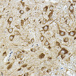 Immunohistochemistry analysis of ATP6V1G2 in paraffin-embedded mouse spinal cord using ATP6V1G2 Rabbit polyclonal antibody (STJ11103194) at dilution of 1:50 (40x lens). Perform high pressure antigen retrieval with 10 mM citrate buffer pH 6. 0 before commencing with immunohistochemistry staining protocol.