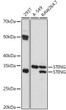 Western blot analysis of various lysates using STING Rabbit polyclonal antibody (STJ11103206) at 1:1000 dilution. Secondary antibody: HRP Goat Anti-Rabbit IgG (H+L) (STJS000856) at 1:10000 dilution. Lysates/proteins: 25 Mu g per lane. Blocking buffer: 3% nonfat dry milk in TBST. Detection: ECL Basic Kit. Exposure time: 5s.