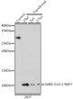 Western blot analysis of extracts of normal 293T cells 293T transfected with NSP7 Protein, using SARS-CoV-2 NSP7 Rabbit polyclonal antibody (STJ11103223) at 1:1000 dilution. Secondary antibody: HRP Goat Anti-Rabbit IgG (H+L) (STJS000856) at 1:10000 dilution. Lysates/proteins: 25 Mu g per lane. Blocking buffer: 3% nonfat dry milk in TBST. Detection: ECL Basic Kit. Exposure time: 30s.