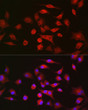 Immunofluorescence analysis of A-549 cells using LLGL1 Rabbit polyclonal antibody (STJ11103225) at dilution of 1:100. Secondary antibody: Cy3 Goat Anti-Rabbit IgG (H+L) at 1:500 dilution. Blue: DAPI for nuclear staining.