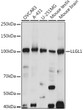 Western blot analysis of various lysates using LLGL1 Rabbit polyclonal antibody (STJ11103225) at 1:1000 dilution. Secondary antibody: HRP Goat Anti-Rabbit IgG (H+L) (STJS000856) at 1:10000 dilution. Lysates/proteins: 25 Mu g per lane. Blocking buffer: 3% nonfat dry milk in TBST. Detection: ECL Basic Kit. Exposure time: 10s.