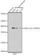 Western blot analysis of extracts of normal 293T cells and 293T transfected with NSP16 Protein, using SARS-CoV-2 NSP16 Rabbit polyclonal antibody (STJ11103255) at 1:5000 dilution. Secondary antibody: HRP Goat Anti-Rabbit IgG (H+L) (STJS000856) at 1:10000 dilution. Lysates/proteins: 25 Mu g per lane. Blocking buffer: 3% nonfat dry milk in TBST. Detection: ECL Basic Kit. Exposure time: 1s.