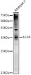 Western blot analysis of lysates from RAW264. 7 cells, using IL12A Rabbit polyclonal antibody (STJ11103288) at 1:1000 dilution. Secondary antibody: HRP Goat Anti-Rabbit IgG (H+L) (STJS000856) at 1:10000 dilution. Lysates/proteins: 25 Mu g per lane. Blocking buffer: 3% nonfat dry milk in TBST. Detection: ECL Basic Kit. Exposure time: 180s.