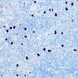 Immunohistochemistry analysis of paraffin-embedded mouse spleen using S100A8 Rabbit polyclonal antibody (STJ11103327) at dilution of 1:50 (40x lens). Perform high pressure antigen retrieval with 10 mM citrate buffer pH 6. 0 before commencing with immunohistochemistry staining protocol.