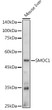 Western blot analysis of extracts of Mouse liver, using SMOC1 antibody (STJ11103334) at 1:1000 dilution. Secondary antibody: HRP Goat Anti-Rabbit IgG (H+L) (STJS000856) at 1:10000 dilution. Lysates/proteins: 25 Mu g per lane. Blocking buffer: 3% nonfat dry milk in TBST. Detection: ECL Basic Kit. Exposure time: 10s.
