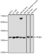 Western blot analysis of various lysates using TRUB1 Rabbit polyclonal antibody (STJ11103344) at 1:500 dilution. Secondary antibody: HRP Goat Anti-Rabbit IgG (H+L) (STJS000856) at 1:10000 dilution. Lysates/proteins: 25 Mu g per lane. Blocking buffer: 3% nonfat dry milk in TBST. Detection: ECL Basic Kit. Exposure time: 30s.
