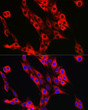 Immunofluorescence analysis of PC-12 cells using UFL1 Rabbit polyclonal antibody (STJ11103362) at dilution of 1:50 (40x lens). Secondary antibody: Cy3 Goat Anti-Rabbit IgG (H+L) at 1:500 dilution. Blue: DAPI for nuclear staining.