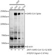 Western blot analysis of various lysates using SARS-CoV Spike Rabbit polyclonal antibody (STJ11103397) at 1:1000 dilution. Secondary antibody: HRP Goat Anti-Rabbit IgG (H+L) (STJS000856) at 1:10000 dilution. Lysates/proteins: 25 Mu g per lane. Blocking buffer: 3% nonfat dry milk in TBST. Detection: ECL Basic Kit. Exposure time: 180s.