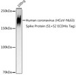 Western blot analysis of lysates from Human coronavirus (HCoV-NL63) Spike Protein (S1+S2 ECDHis Tag) , using HCoV-NL63 Spike S2 Rabbit polyclonal antibody (STJ11103402) at 1:1000 dilution. Secondary antibody: HRP Goat Anti-Rabbit IgG (H+L) (STJS000856) at 1:10000 dilution. Lysates/proteins: 25 Mu g per lane. Blocking buffer: 3% nonfat dry milk in TBST. Detection: ECL Basic Kit. Exposure time: 90s.
