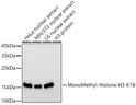 Western blot analysis of extracts of various cell lines, using MonoMethyl-Histone H3-K18 antibody (STJ11103411) at 1:1000 dilution. Secondary antibody: HRP Goat Anti-rabbit IgG (H+L) (STJS000856) at 1:10000 dilution. Lysates/proteins: 25 Mu g per lane. Blocking buffer: 3% non-fat dry milk in TBST. Detection: ECL Basic Kit. Exposure time: 30s.