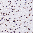 Immunohistochemistry analysis of paraffin-embedded rat brain using MonoMethyl-Histone H3-K18 rabbit monoclonal antibody (STJ11103411) at dilution of 1:100 (40x lens). Perform high pressure antigen retrieval with 10 mM citrate buffer pH 6. 0 before commencing with immunohistochemistry staining protocol.