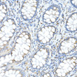 Immunohistochemistry analysis of FAM3A in paraffin-embedded human colon using FAM3A Rabbit polyclonal antibody (STJ11103413) at dilution of 1:50 (40x lens). Perform high pressure antigen retrieval with 10 mM citrate buffer pH 6. 0 before commencing with immunohistochemistry staining protocol.