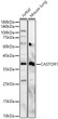 Western blot analysis of various lysates, using CASTOR1 Rabbit polyclonal antibody (STJ11103420) at 1:1000 dilution. Secondary antibody: HRP Goat Anti-Rabbit IgG (H+L) (STJS000856) at 1:10000 dilution. Lysates/proteins: 25ug per lane. Blocking buffer: 3% nonfat dry milk in TBST. Detection: ECL Basic Kit. Exposure time: 60s.