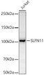 Western blot analysis of Jurkat, using SLFN11 antibody (STJ11103467) at 1:1000 dilution. Secondary antibody: HRP Goat Anti-Rabbit IgG (H+L) (STJS000856) at 1:10000 dilution. Lysates/proteins: 25 Mu g per lane. Blocking buffer: 3% nonfat dry milk in TBST. Detection: ECL Basic Kit. Exposure time: 30s.