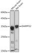 Western blot analysis of extracts of various cell lines, using DARPP32 Rabbit monoclonal antibody (STJ11103546) at 1:1000 dilution. Secondary antibody: HRP Goat Anti-Rabbit IgG (H+L) (STJS000856) at 1:10000 dilution. Lysates/proteins: 25 Mu g per lane. Blocking buffer: 3% nonfat dry milk in TBST. Detection: ECL Basic Kit. Exposure time: 1s.
