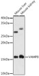 Western blot analysis of extracts of various cell lines, using VAMP8 antibody (STJ11103576) at 1:1000 dilution. Secondary antibody: HRP Goat Anti-Rabbit IgG (H+L) (STJS000856) at 1:10000 dilution. Lysates/proteins: 25 Mu g per lane. Blocking buffer: 3% nonfat dry milk in TBST. Detection: ECL Enhanced Kit. Exposure time: 180s.