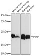 Immunohistochemistry analysis of paraffin-embedded mouse skin using PERP Rabbit monoclonal antibody (STJ11103593) at dilution of 1:100 (40x lens). Perform microwave antigen retrieval with 10 mM Tris/EDTA buffer pH 9. 0 before commencing with immunohistochemistry staining protocol.