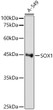 Western blot analysis of A-549, using SOX1 Rabbit monoclonal antibody (STJ11103595) at 1:1000 dilution. Secondary antibody: HRP Goat Anti-Rabbit IgG (H+L) (STJS000856) at 1:10000 dilution. Lysates/proteins: 25 Mu g per lane. Blocking buffer: 3% nonfat dry milk in TBST. Detection: ECL Basic Kit. Exposure time: 180s.