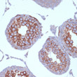 Immunohistochemistry analysis of paraffin-embedded rat testis using KIF3A Rabbit monoclonal antibody (STJ11103614) at dilution of 1:100 (40x lens). Perform microwave antigen retrieval with 10 mM Tris/EDTA buffer pH 9. 0 before commencing with immunohistochemistry staining protocol.