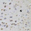 Immunohistochemistry analysis of paraffin-embedded Mouse brain using PFKP Rabbit pAb (STJ11103617) (40x lens). Microwave antigen retrieval performed with 0. 01M PBS Buffer (pH 7. 2) prior to immunohistochemistry staining.